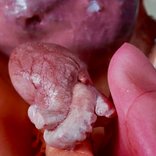 Medical Simulation Model — Silicone Heart for Healthcare Training Hyperrealistic silicone anatomical model for medical simulation training — synthetic product, not real human tissue